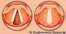 colored drawing showing human vocal folds during inspiration and phonation